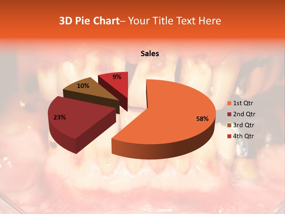 A Close Up Of A Person's Teeth With Gums PowerPoint Template