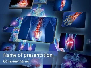 A Medical Powerpoint Presentation With Images Of Bones And Bones PowerPoint Template