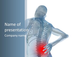 A Skeleton Holding His Back In Pain Powerpoint Presentation PowerPoint Template