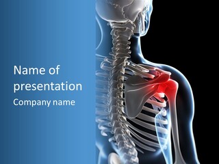 A Skeleton With A Highlighted Shoulder Is Shown In This Powerpoint Presentation PowerPoint Template