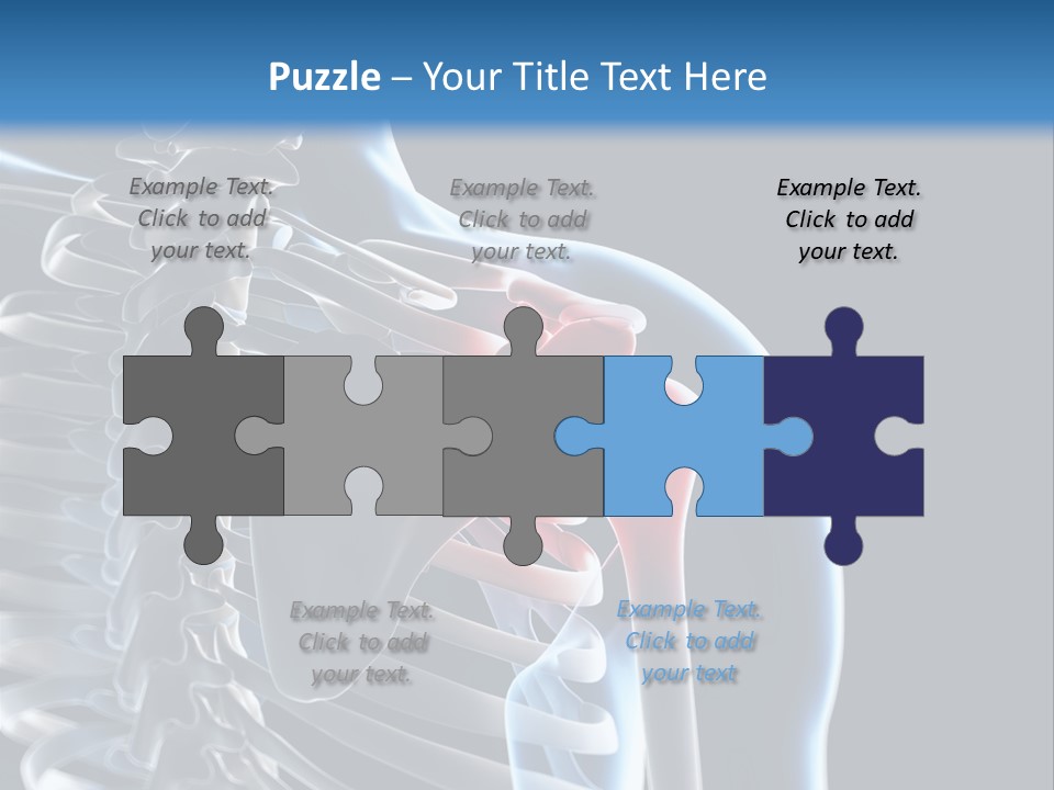 A Skeleton With A Highlighted Shoulder Is Shown In This Powerpoint Presentation PowerPoint Template