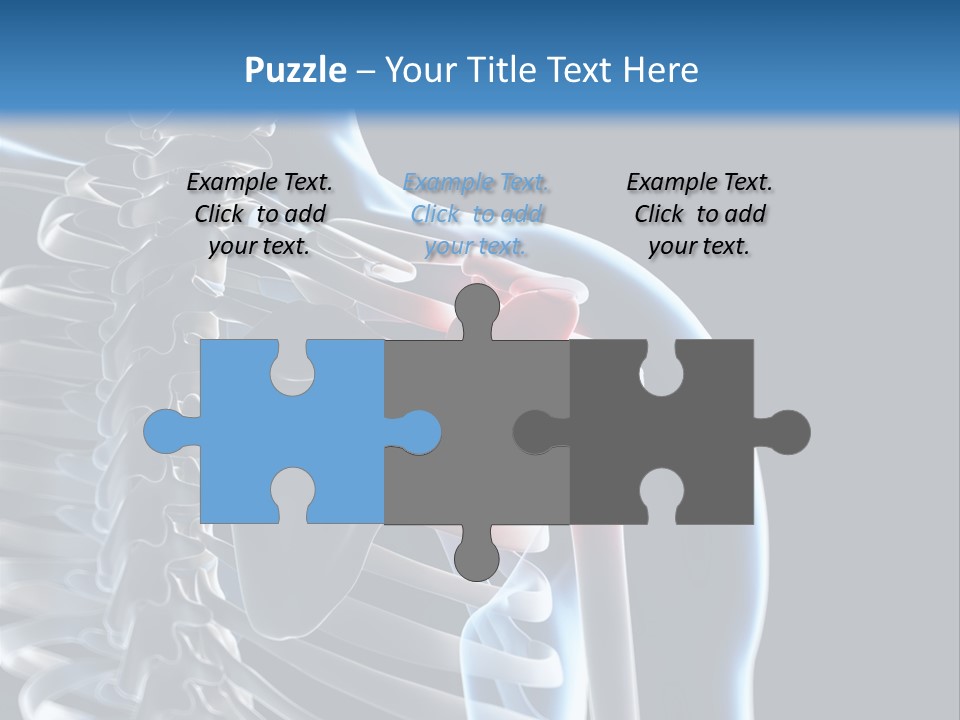 A Skeleton With A Highlighted Shoulder Is Shown In This Powerpoint Presentation PowerPoint Template