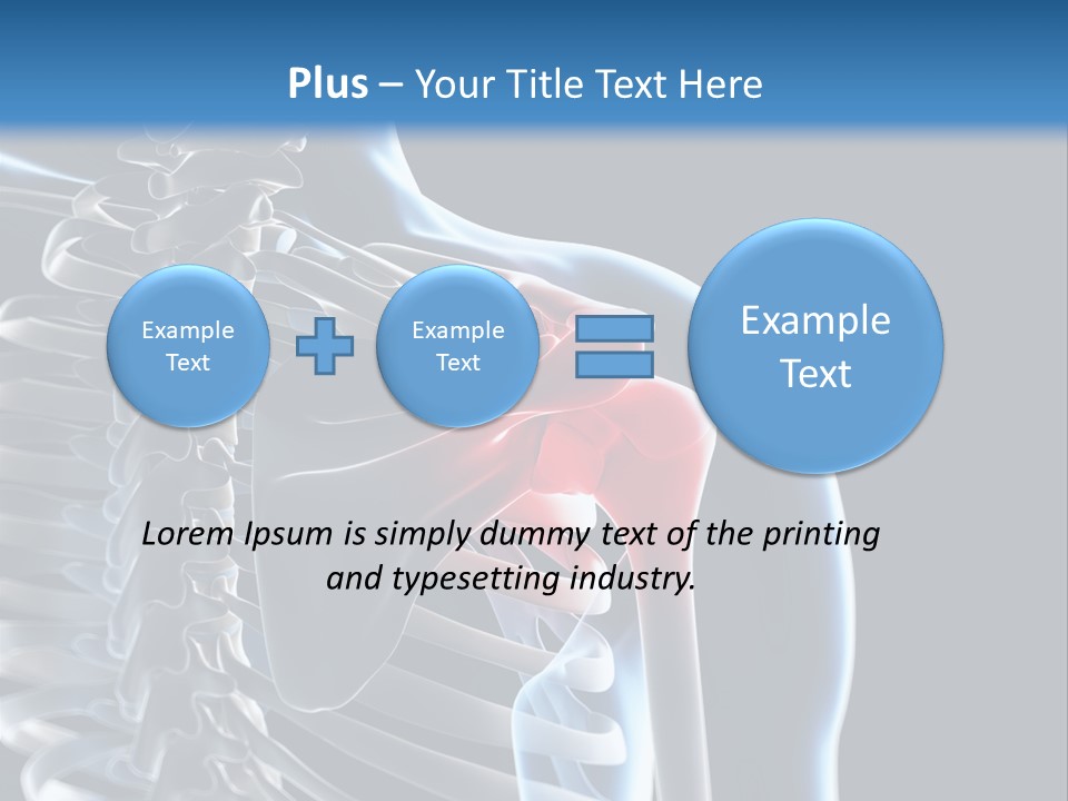 A Skeleton With A Highlighted Shoulder Is Shown In This Powerpoint Presentation PowerPoint Template
