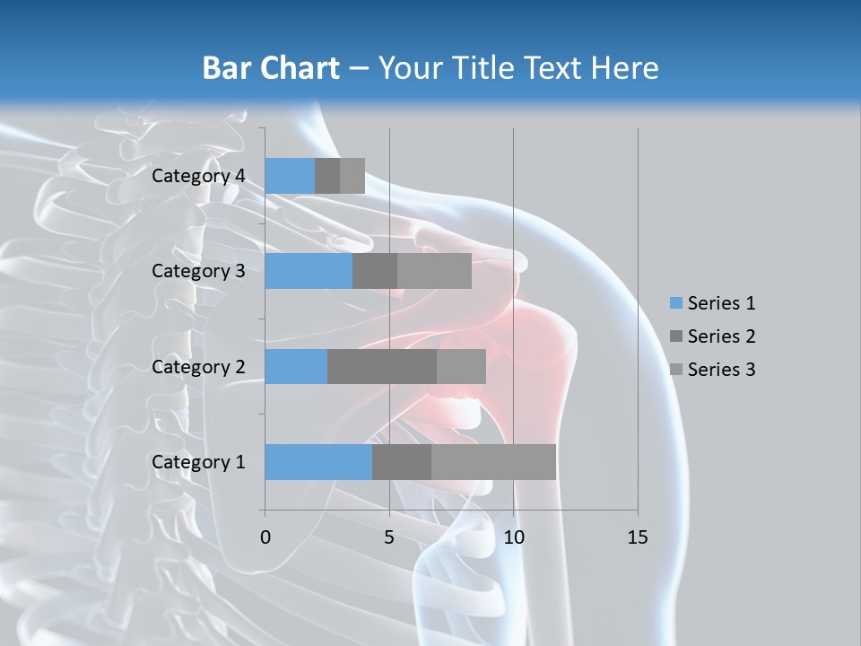 A Skeleton With A Highlighted Shoulder Is Shown In This Powerpoint Presentation PowerPoint Template