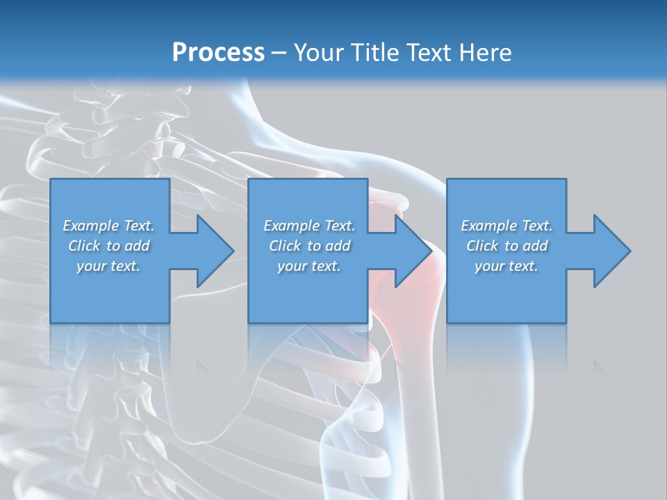 A Skeleton With A Highlighted Shoulder Is Shown In This Powerpoint Presentation PowerPoint Template