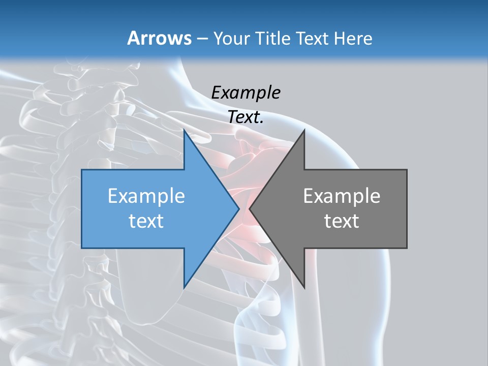 A Skeleton With A Highlighted Shoulder Is Shown In This Powerpoint Presentation PowerPoint Template