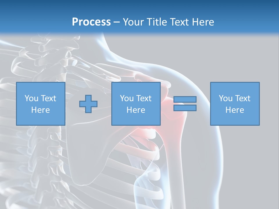A Skeleton With A Highlighted Shoulder Is Shown In This Powerpoint Presentation PowerPoint Template