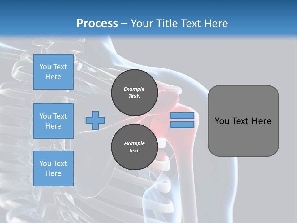 A Skeleton With A Highlighted Shoulder Is Shown In This Powerpoint Presentation PowerPoint Template