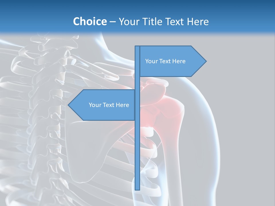 A Skeleton With A Highlighted Shoulder Is Shown In This Powerpoint Presentation PowerPoint Template