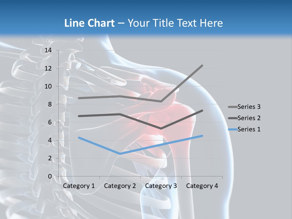 A Skeleton With A Highlighted Shoulder Is Shown In This Powerpoint Presentation PowerPoint Template
