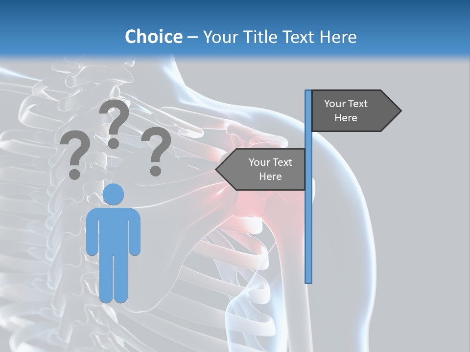 A Skeleton With A Highlighted Shoulder Is Shown In This Powerpoint Presentation PowerPoint Template
