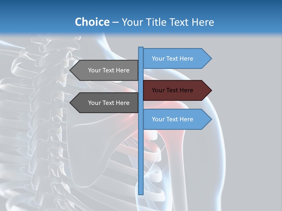 A Skeleton With A Highlighted Shoulder Is Shown In This Powerpoint Presentation PowerPoint Template