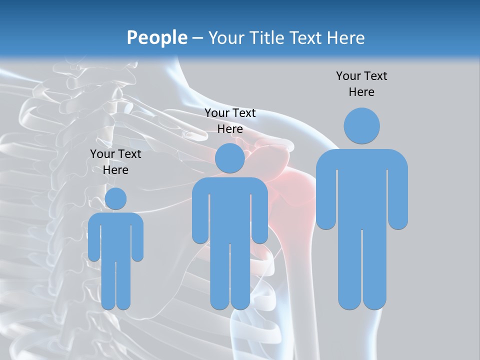A Skeleton With A Highlighted Shoulder Is Shown In This Powerpoint Presentation PowerPoint Template