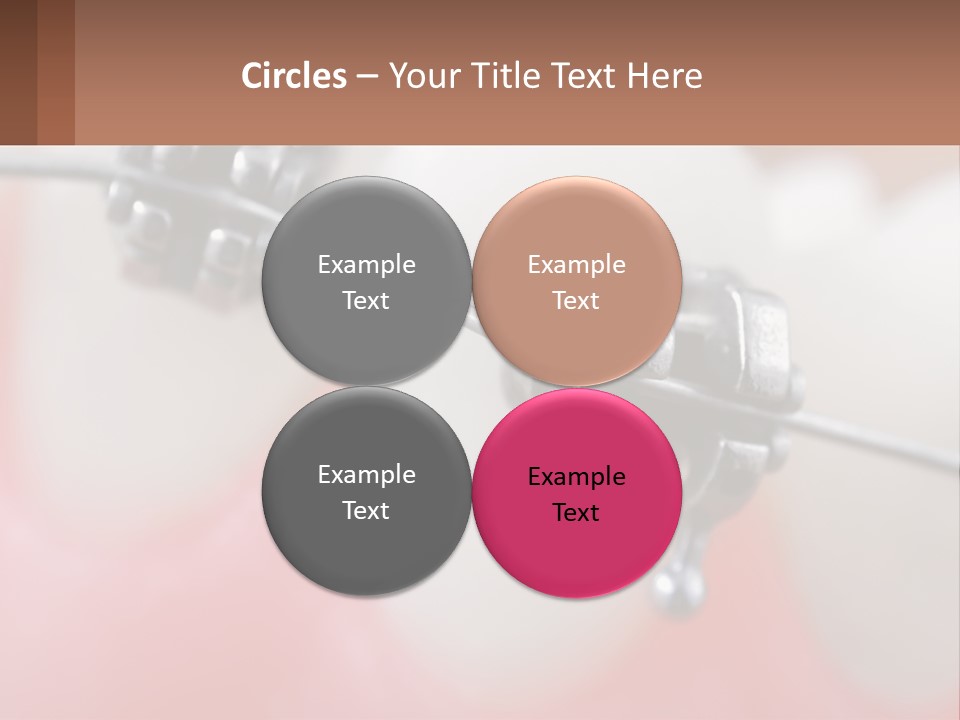 A Tooth With Braces On It Powerpoint Template PowerPoint Template