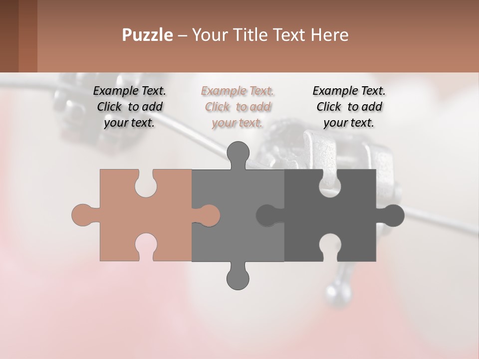 A Tooth With Braces On It Powerpoint Template PowerPoint Template