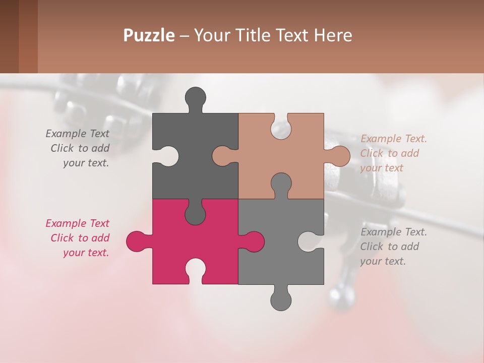 A Tooth With Braces On It Powerpoint Template PowerPoint Template