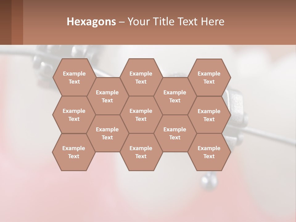 A Tooth With Braces On It Powerpoint Template PowerPoint Template