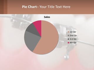 A Tooth With Braces On It Powerpoint Template PowerPoint Template