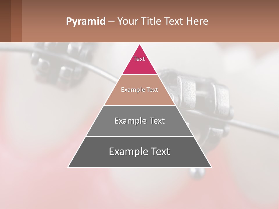 A Tooth With Braces On It Powerpoint Template PowerPoint Template