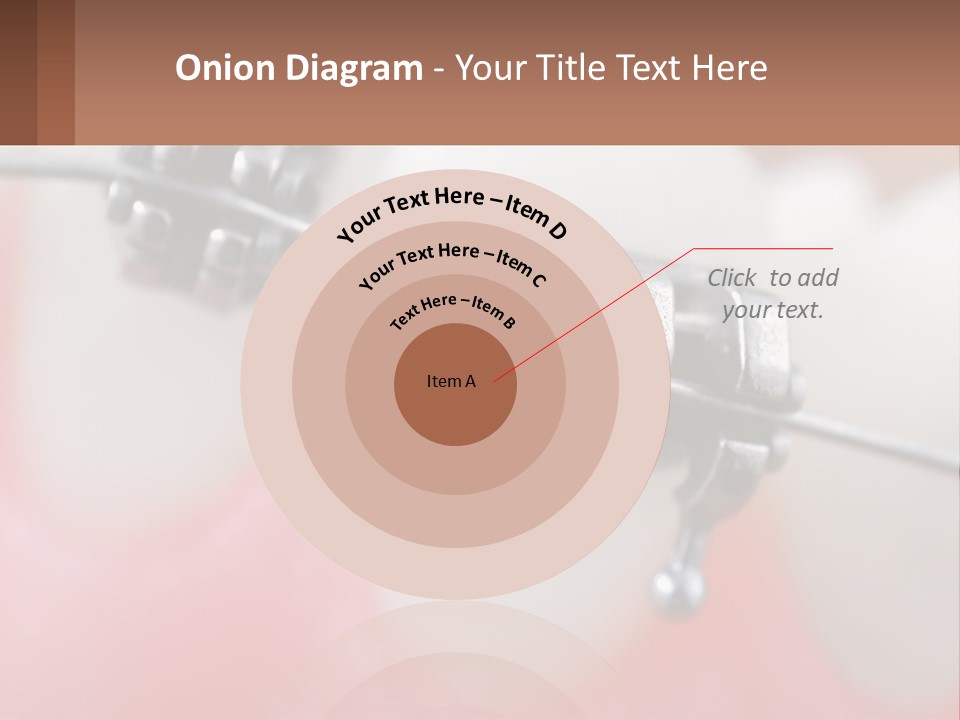 A Tooth With Braces On It Powerpoint Template PowerPoint Template