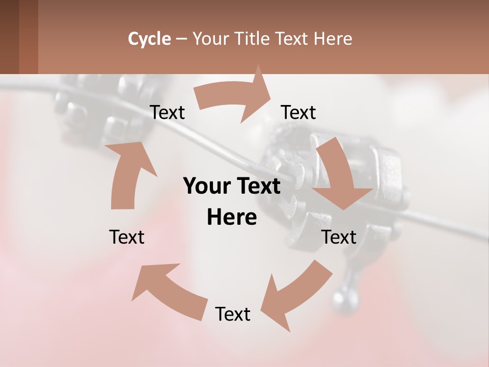 A Tooth With Braces On It Powerpoint Template PowerPoint Template