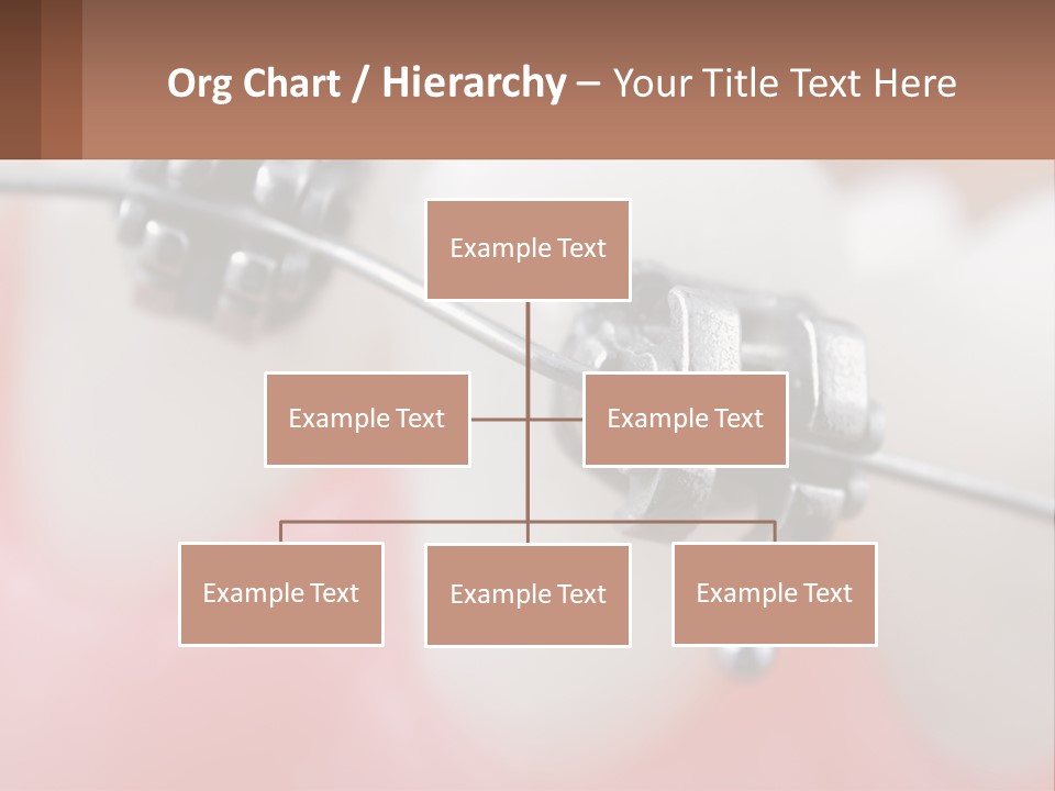 A Tooth With Braces On It Powerpoint Template PowerPoint Template