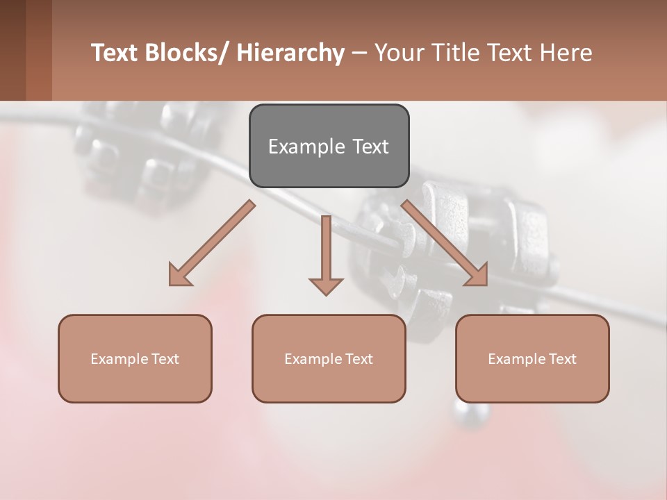 A Tooth With Braces On It Powerpoint Template PowerPoint Template