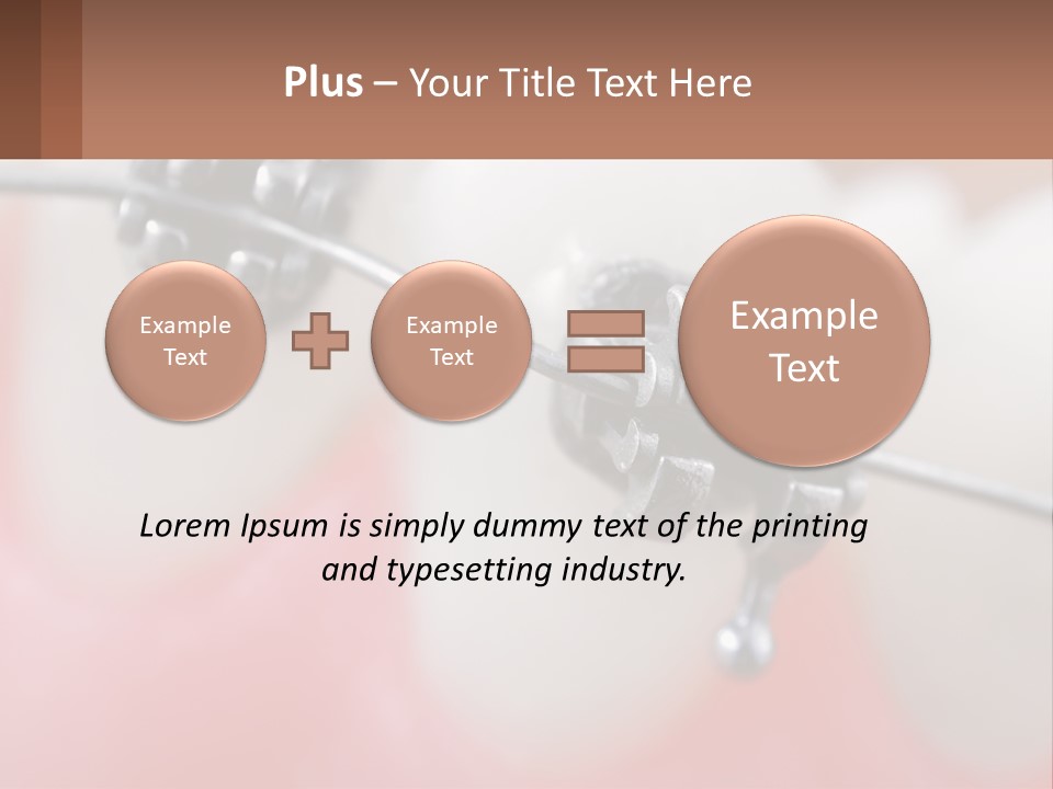 A Tooth With Braces On It Powerpoint Template PowerPoint Template