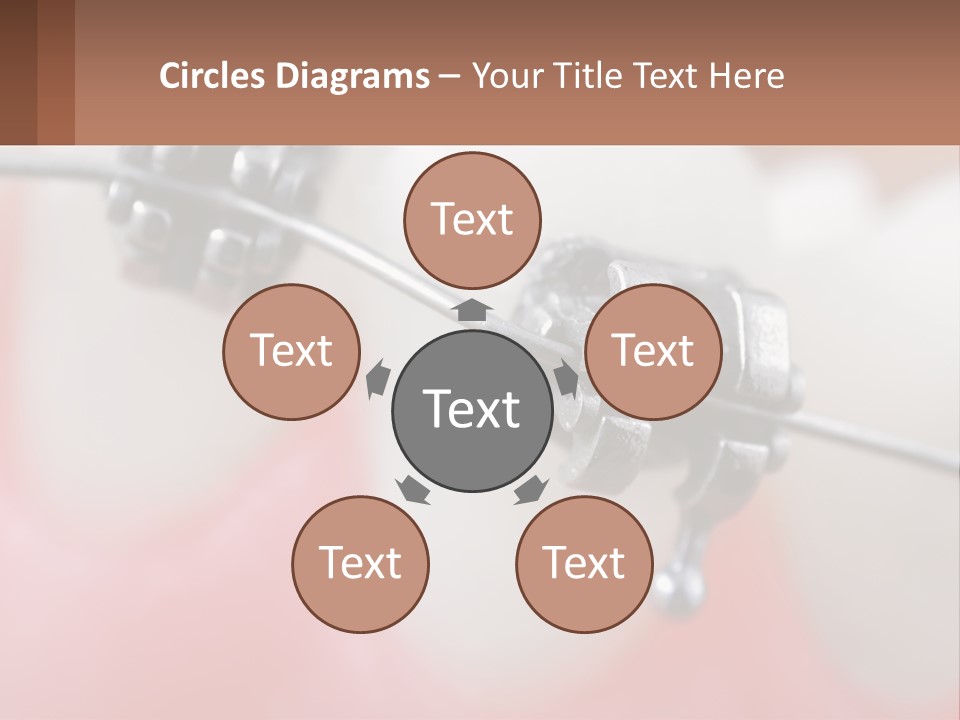 A Tooth With Braces On It Powerpoint Template PowerPoint Template