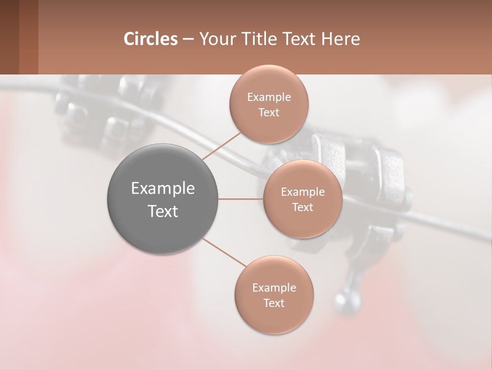 A Tooth With Braces On It Powerpoint Template PowerPoint Template