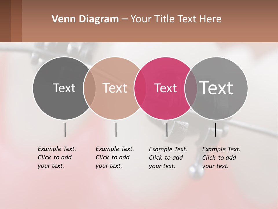 A Tooth With Braces On It Powerpoint Template PowerPoint Template