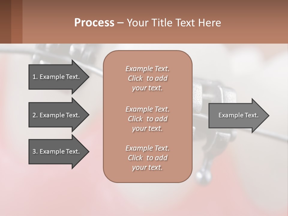 A Tooth With Braces On It Powerpoint Template PowerPoint Template