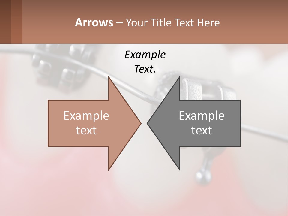 A Tooth With Braces On It Powerpoint Template PowerPoint Template