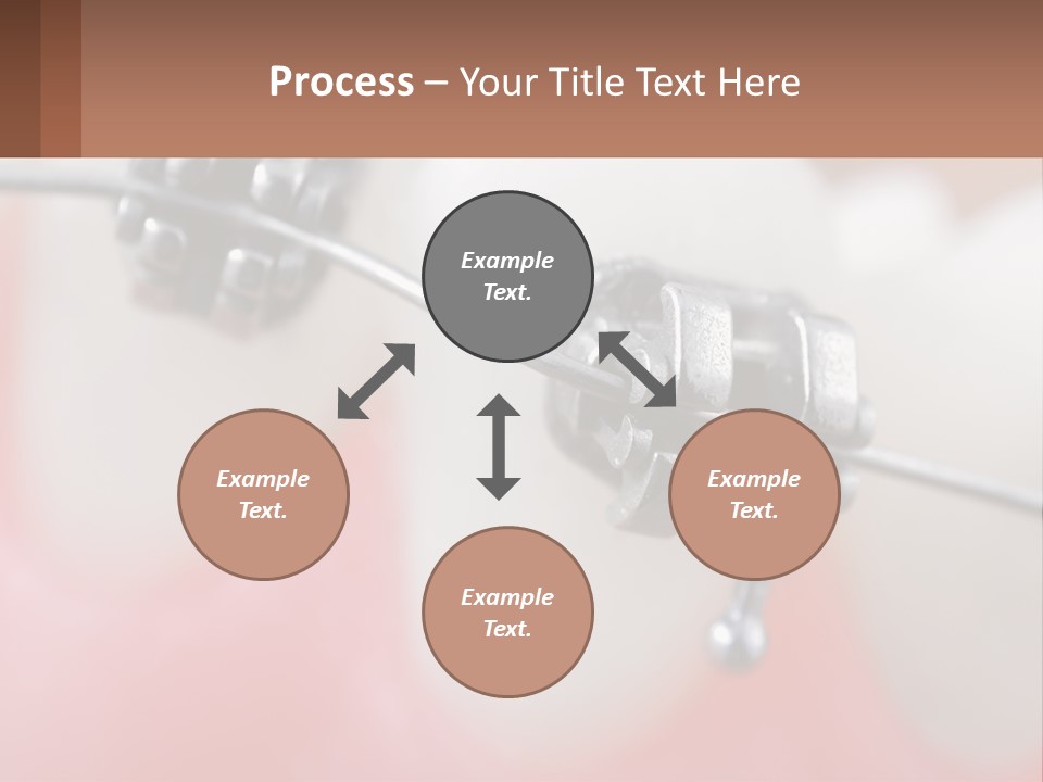 A Tooth With Braces On It Powerpoint Template PowerPoint Template