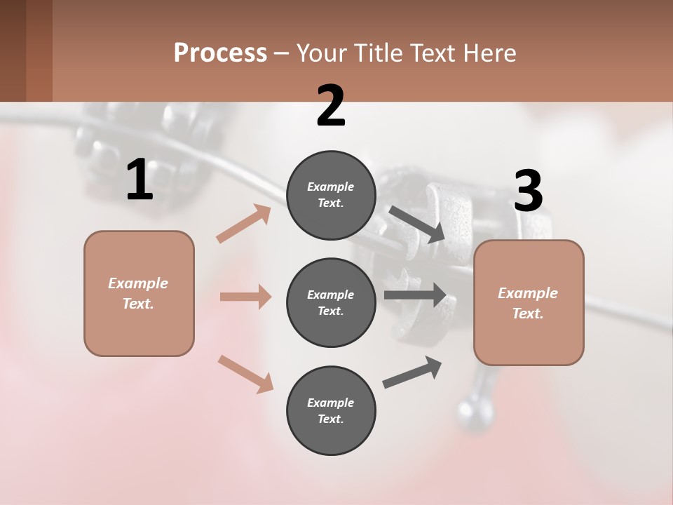 A Tooth With Braces On It Powerpoint Template PowerPoint Template