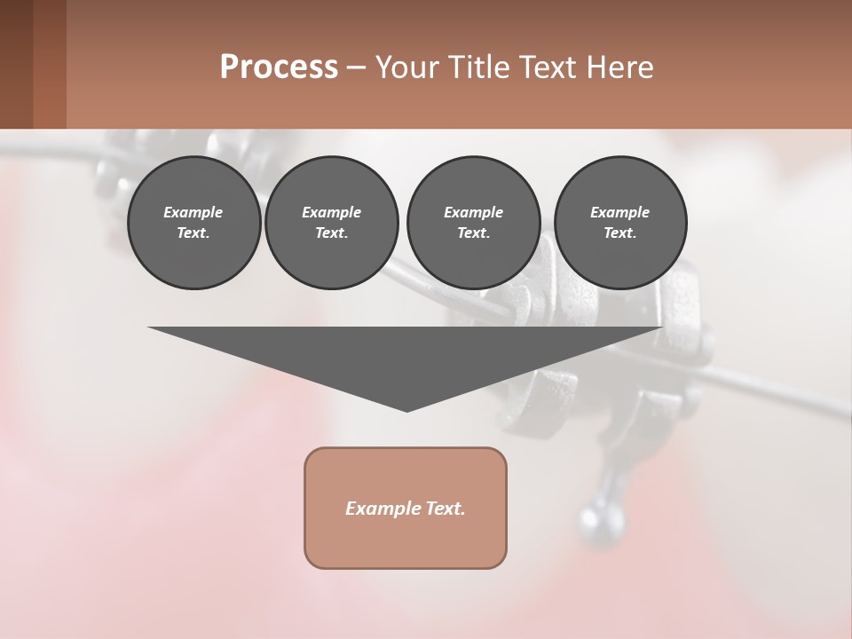 A Tooth With Braces On It Powerpoint Template PowerPoint Template