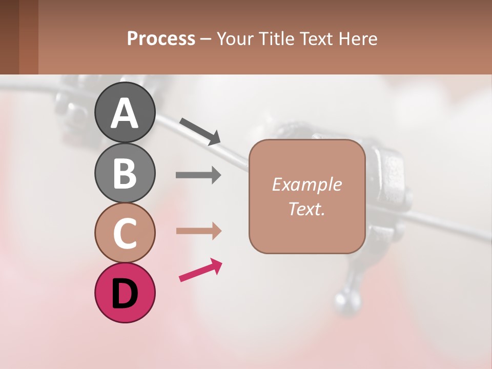 A Tooth With Braces On It Powerpoint Template PowerPoint Template