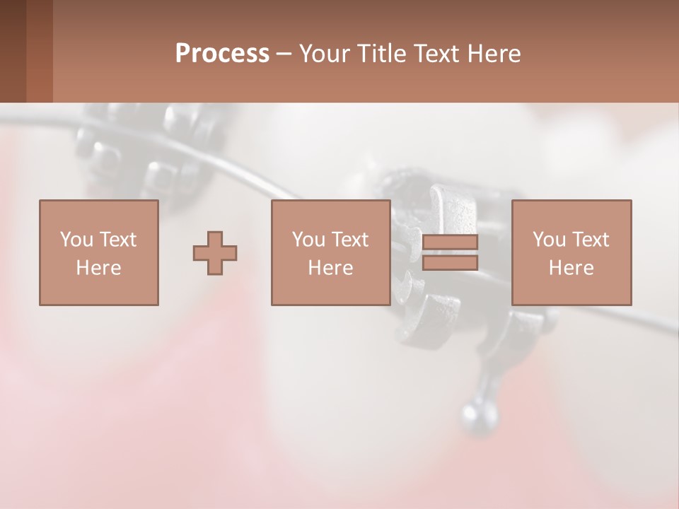 A Tooth With Braces On It Powerpoint Template PowerPoint Template