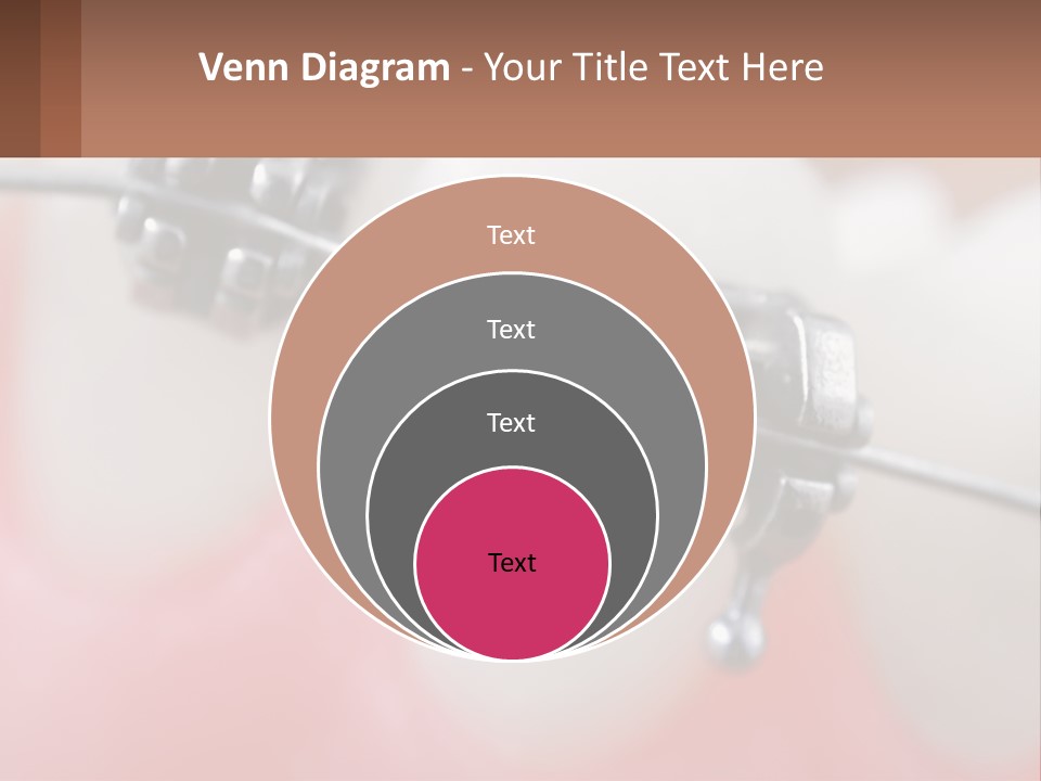 A Tooth With Braces On It Powerpoint Template PowerPoint Template