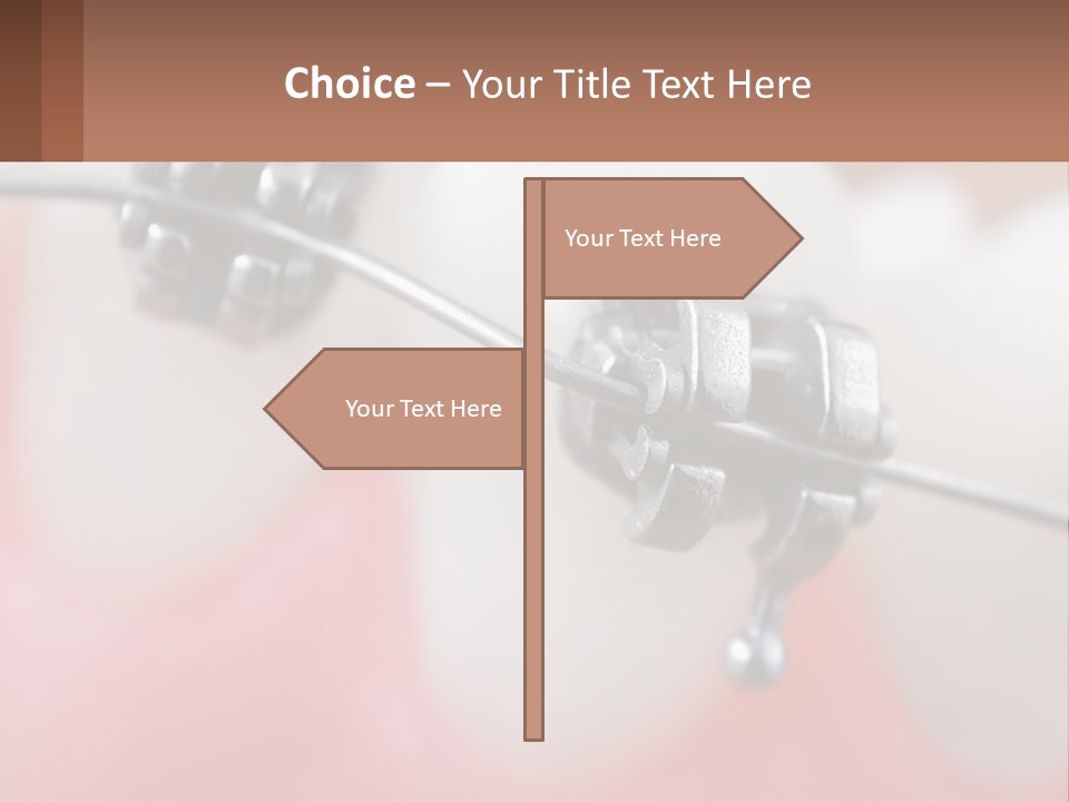 A Tooth With Braces On It Powerpoint Template PowerPoint Template