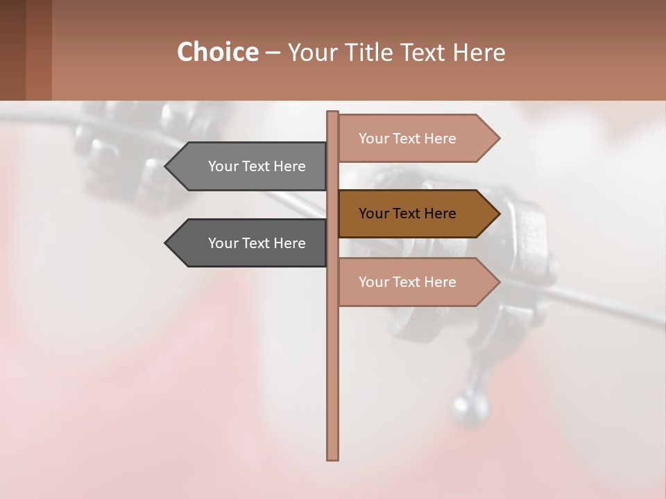 A Tooth With Braces On It Powerpoint Template PowerPoint Template