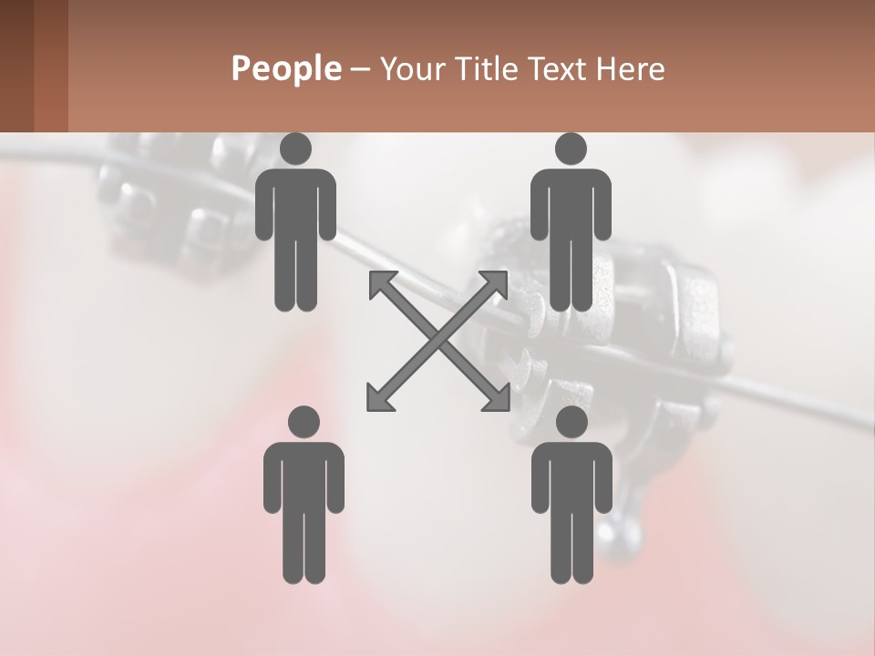 A Tooth With Braces On It Powerpoint Template PowerPoint Template