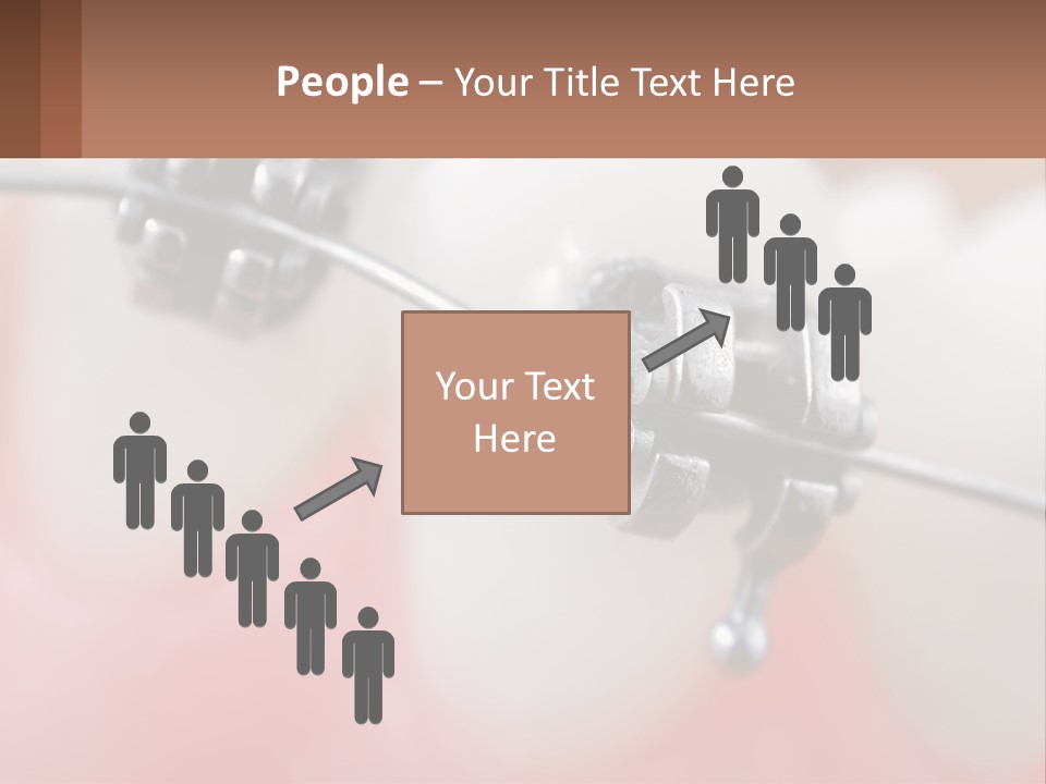 A Tooth With Braces On It Powerpoint Template PowerPoint Template