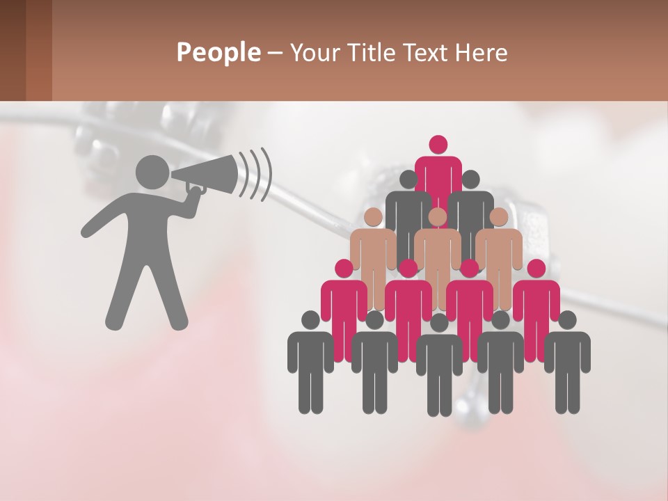 A Tooth With Braces On It Powerpoint Template PowerPoint Template