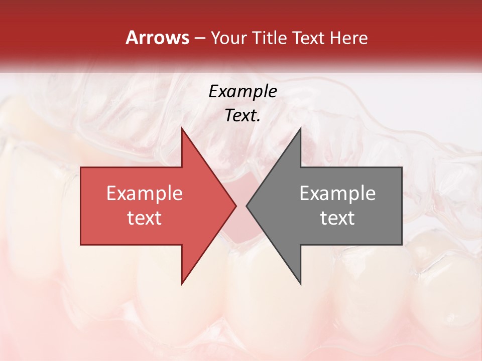 A Tooth With Gums And Gums On It PowerPoint Template