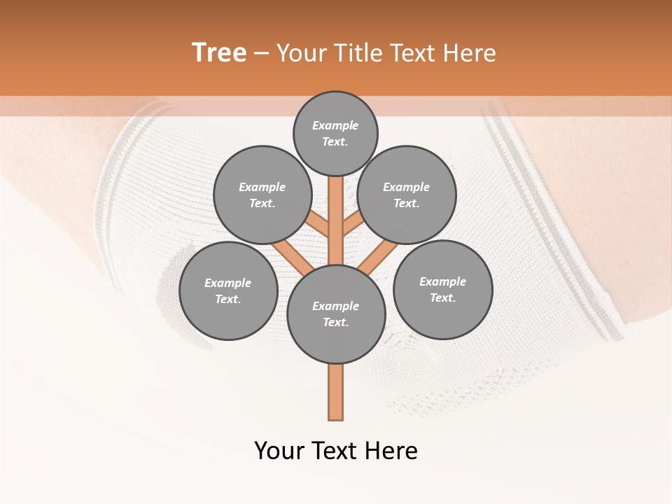 A Person With A Cast On Their Arm PowerPoint Template