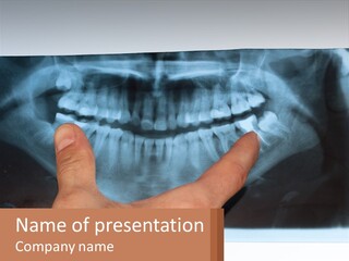 A Person Holding Their Hand Up In Front Of A X - Ray PowerPoint Template