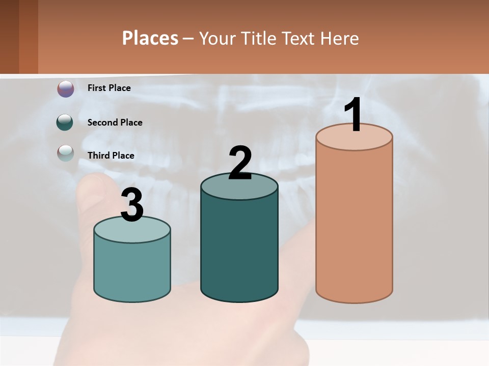A Person Holding Their Hand Up In Front Of A X - Ray PowerPoint Template