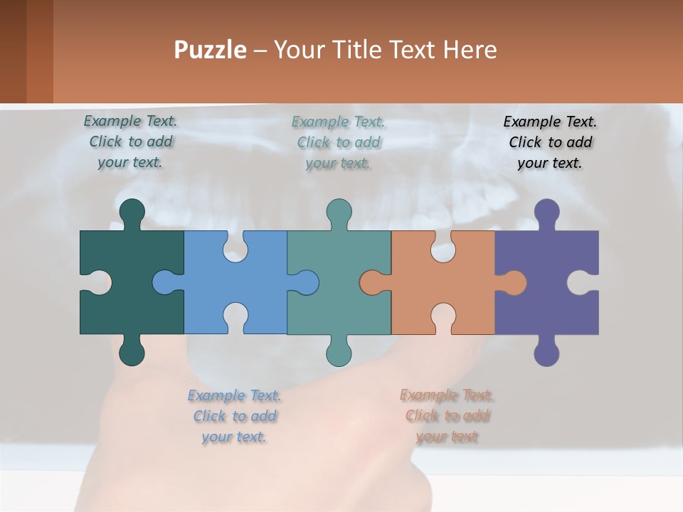 A Person Holding Their Hand Up In Front Of A X - Ray PowerPoint Template