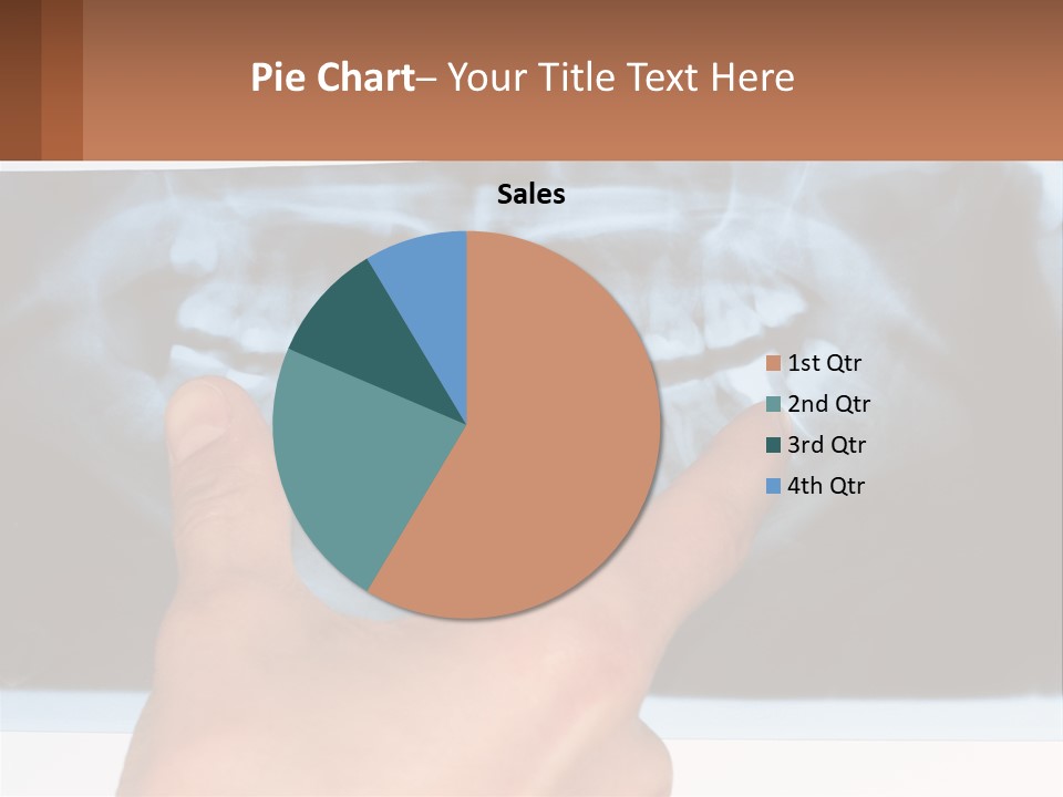 A Person Holding Their Hand Up In Front Of A X - Ray PowerPoint Template